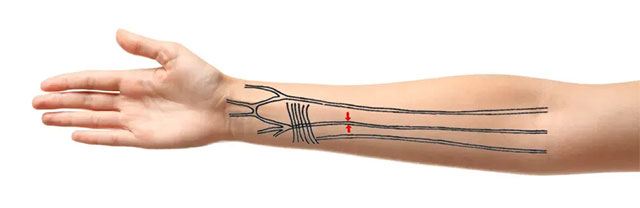 evolutionary-angle-humans-are-developing-extra-arteries-in-the-forearm-picture-1-Jgl80aFkk.jpg